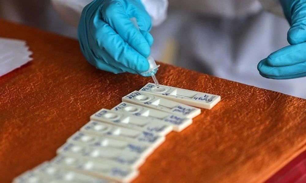 Κορονοϊός: Και με συμμετοχή Ελλήνων επιστημόνων το νέο τεστ της Οξφόρδης